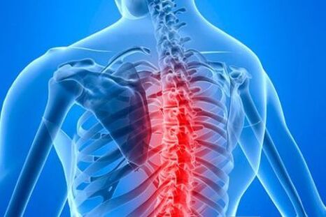 Osteochondroza klatki piersiowej