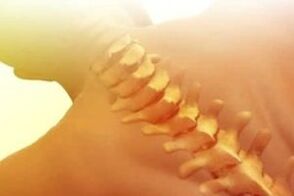 osteochondroza jak leczyć